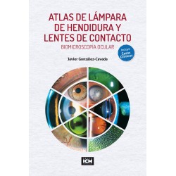 Atlas de Lámpara de Hendidura y Lentes de Contacto