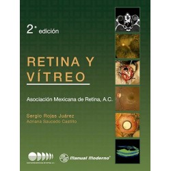 Retina y Vitreo