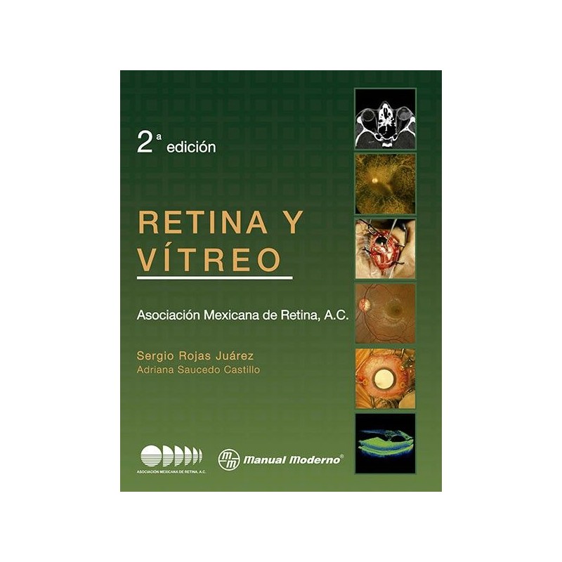 Retina y Vitreo
