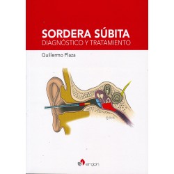 Sordera Súbita. Diagnóstico...