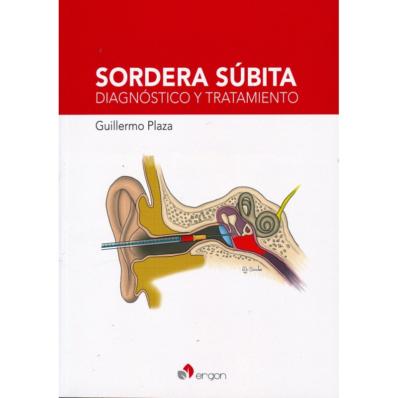 Sordera Súbita. Diagnóstico y Tratamiento