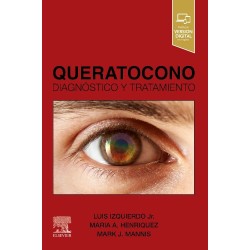 Queratocono. Diagnóstico y...