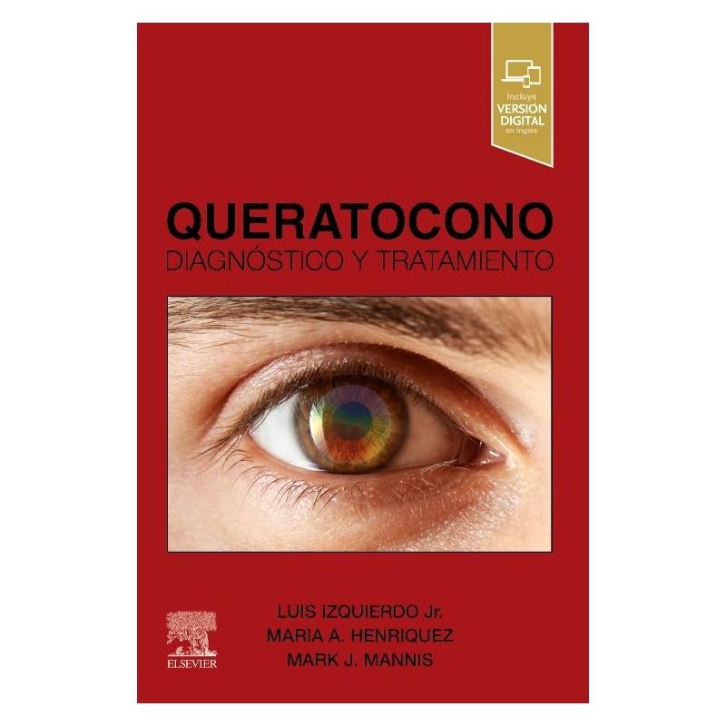 Queratocono. Diagnóstico y Tratamiento