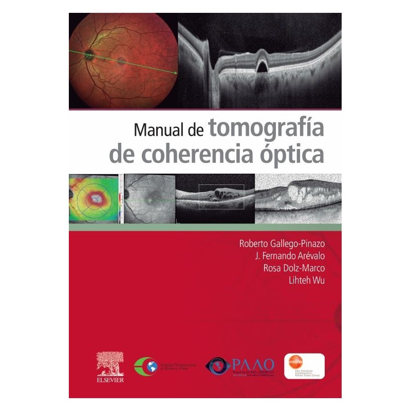Manual de Tomografía de Coherencia Óptica (OCT)