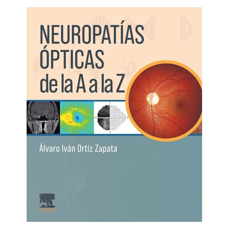 Neuropatías Ópticas de la A a la Z