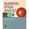 Neuropatías Ópticas de la A a la Z