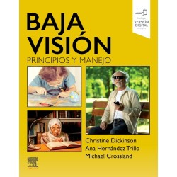 BAJA VISIÓN. PRINCIPIOS Y...