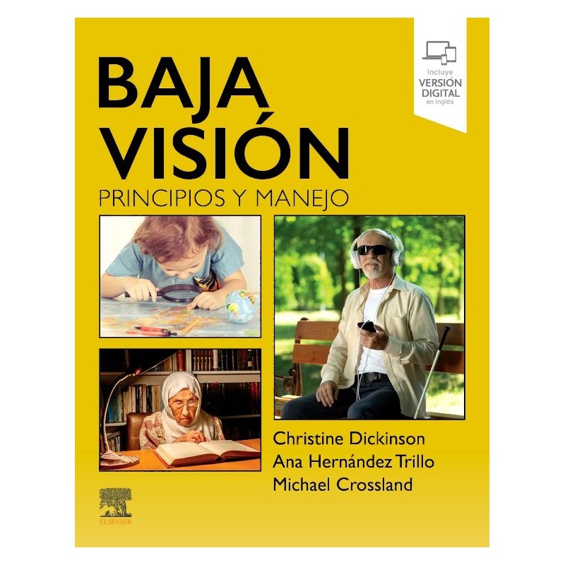 BAJA VISIÓN. PRINCIPIOS Y MANEJO